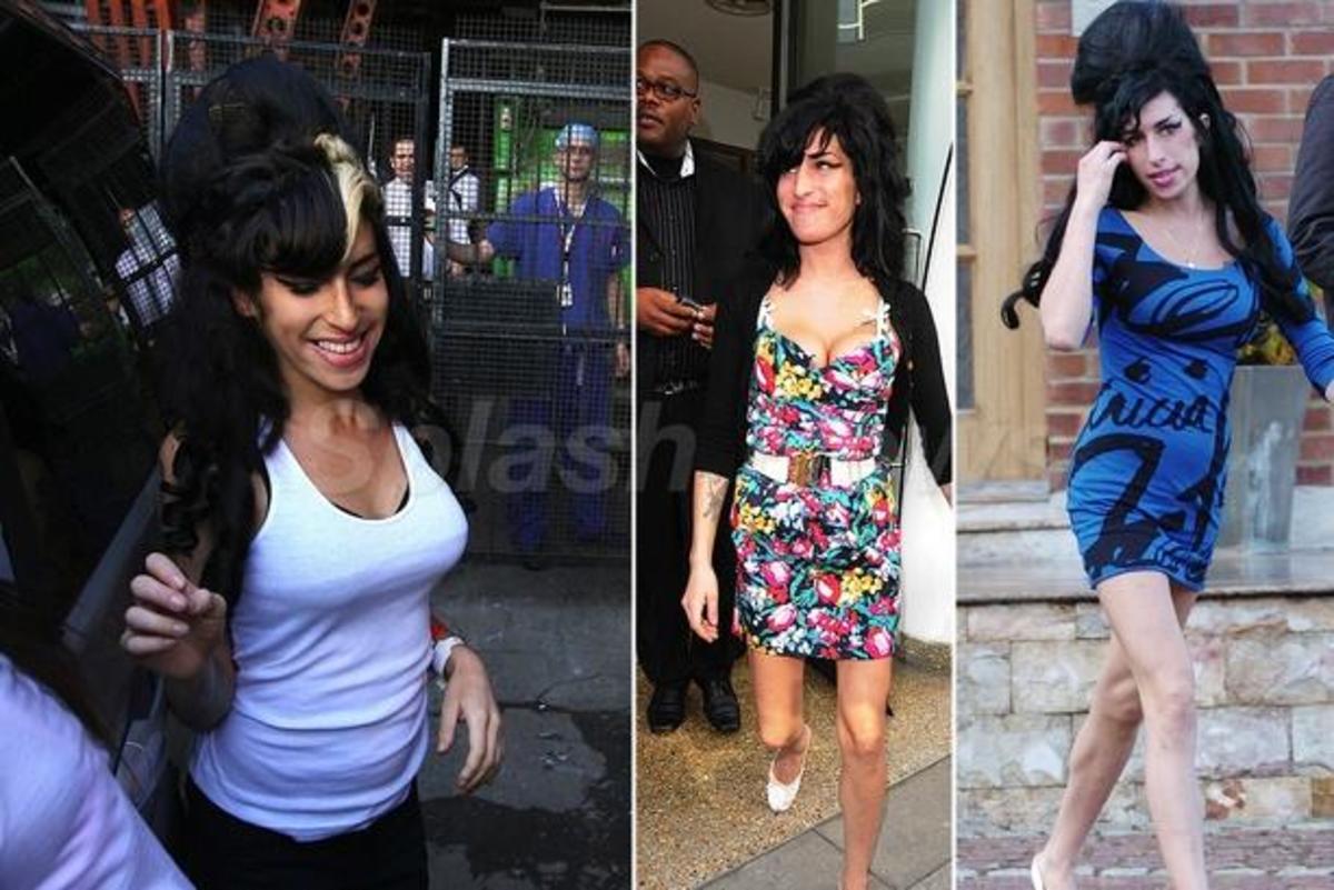 Η Winehouse και το “ελαττωματικό” στήθος!