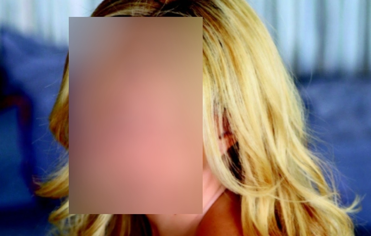 Ελληνίδα δημοσιογραφος έκανε μπότοξ και μαρμάρωσε το μέτωπό της!