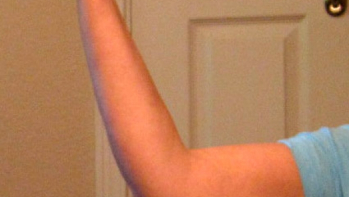 Πλαδαρό μπράτσο; Υπάρχει λύση για τις γυναίκες