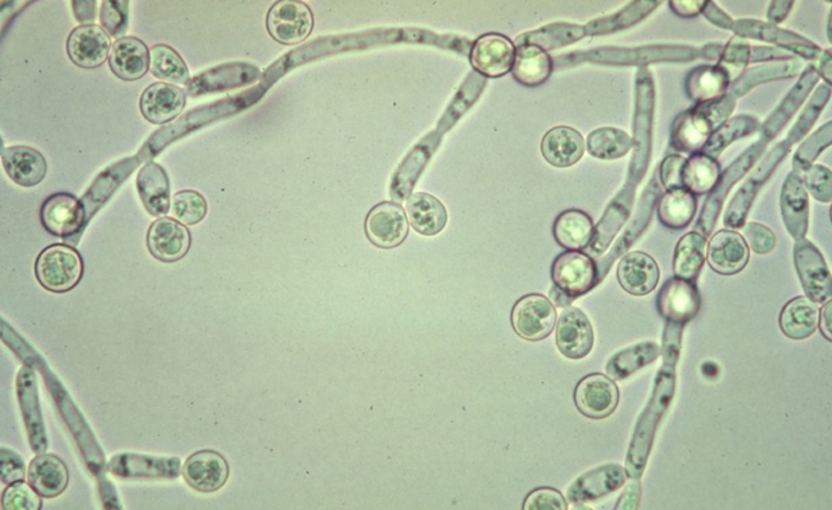 Candida albicans – ο ύπουλος εχθρός που ζει μέσα μας!