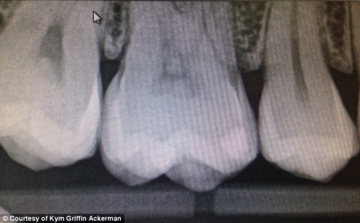 Είδε τον Χριστό… X-ray!  (ΦΩΤΟ)