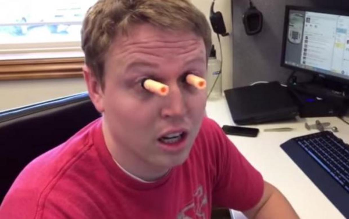 Κόλλησε στα μάτια του βεντούζες και το βίντεο του σαρώνει!