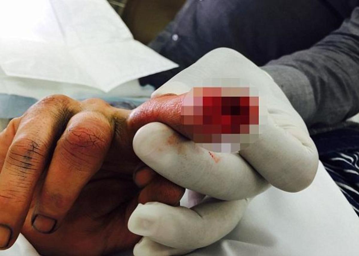 Johnny Depp: Έκοψε κομμάτι από το δάχτυλό του και έγραψε για τον γκόμενο της γυναίκας του! Σοκαριστκές φωτογραφίες