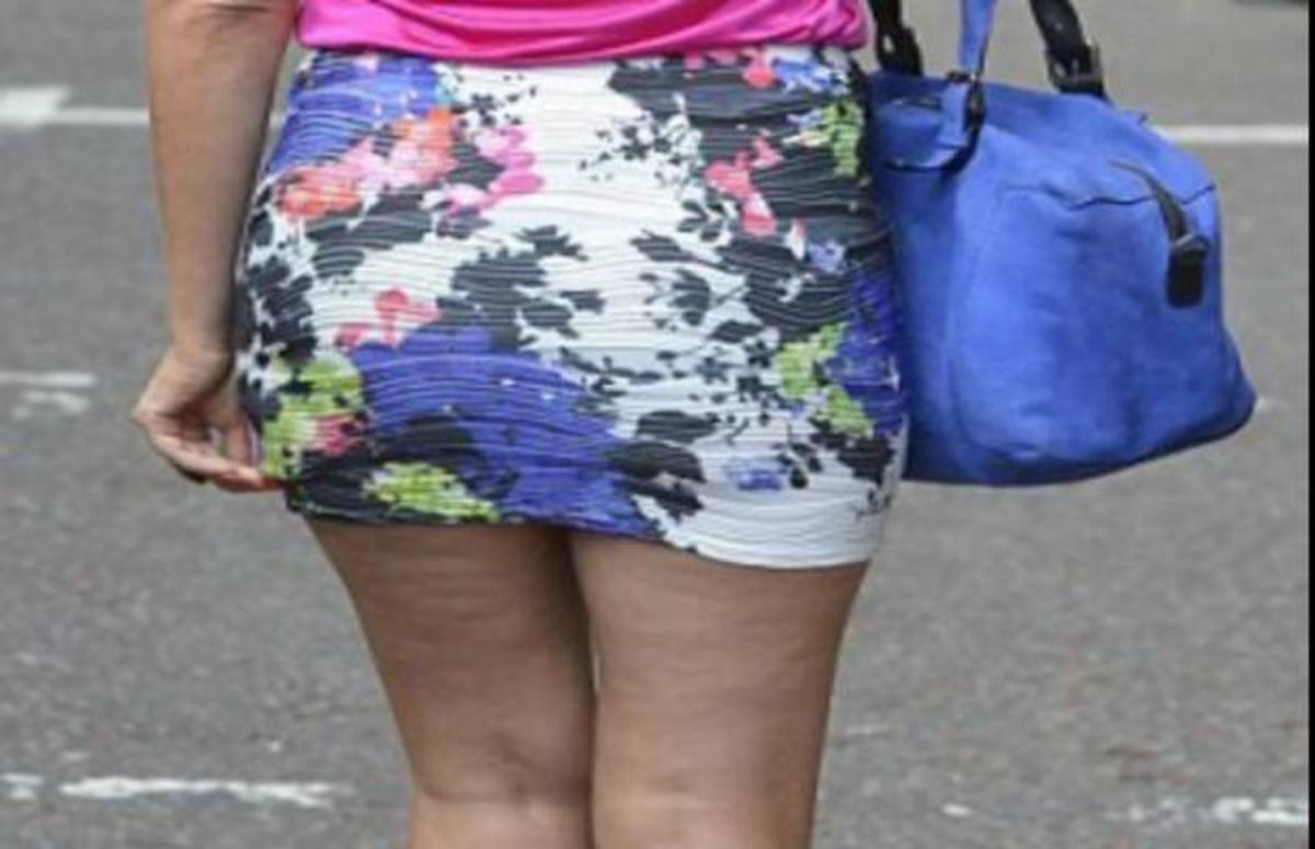 Ακόμα και η πιο σέξυ γυναίκα στον κόσμο έχει κυτταρίτιδα!