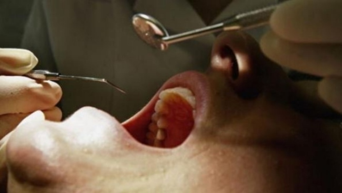 Προσοχή: Δείτε με πώς ο διαβήτης συνδέεται με την υγεία των δοντιών