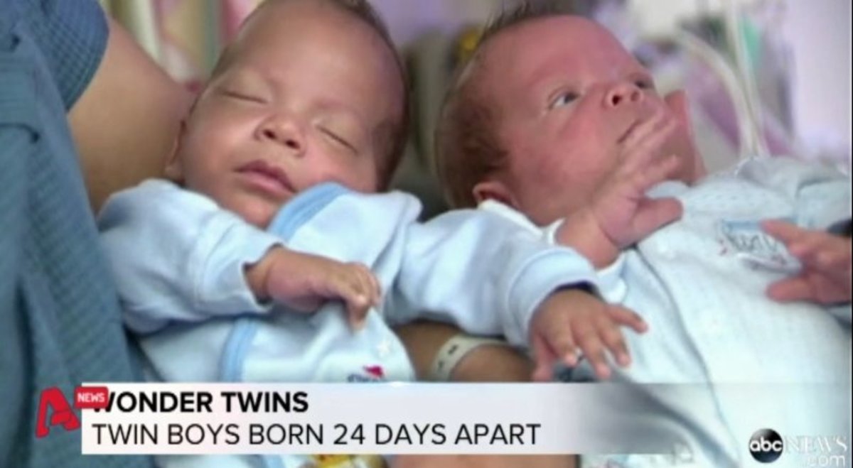 Δίδυμα με… διαφορά