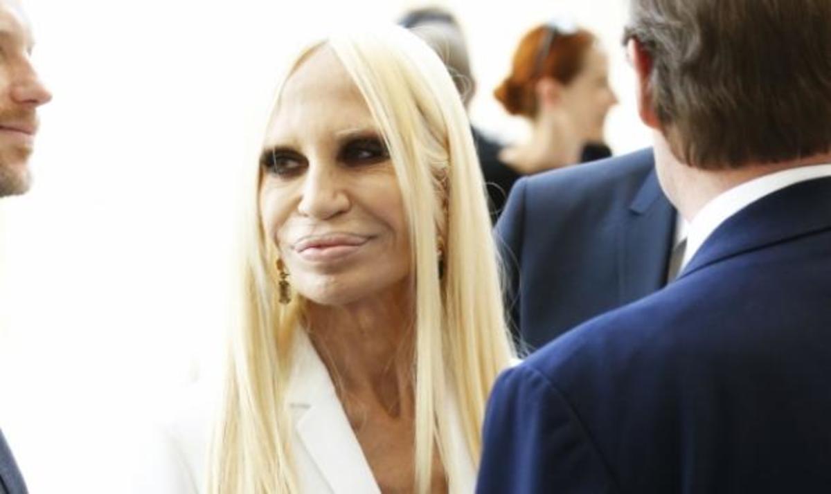 Σοκάρει η Donatella Versace με το παραμορφωμένο πρόσωπό της
