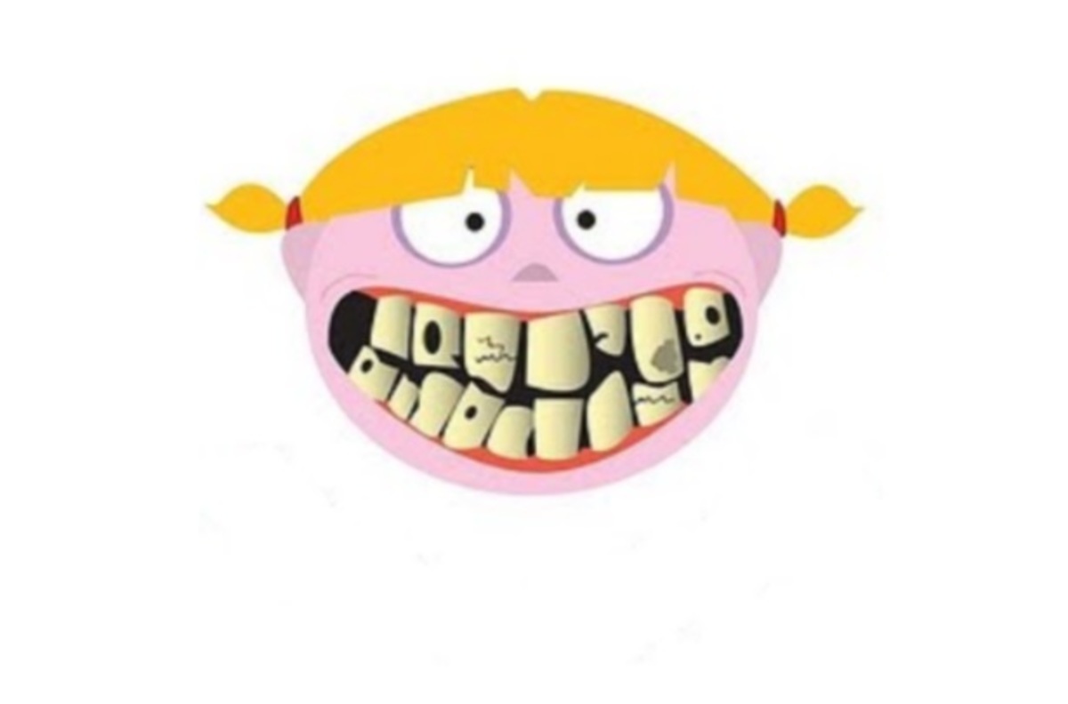 Αυτά είναι τα χειρότερα δόντια της showbiz!