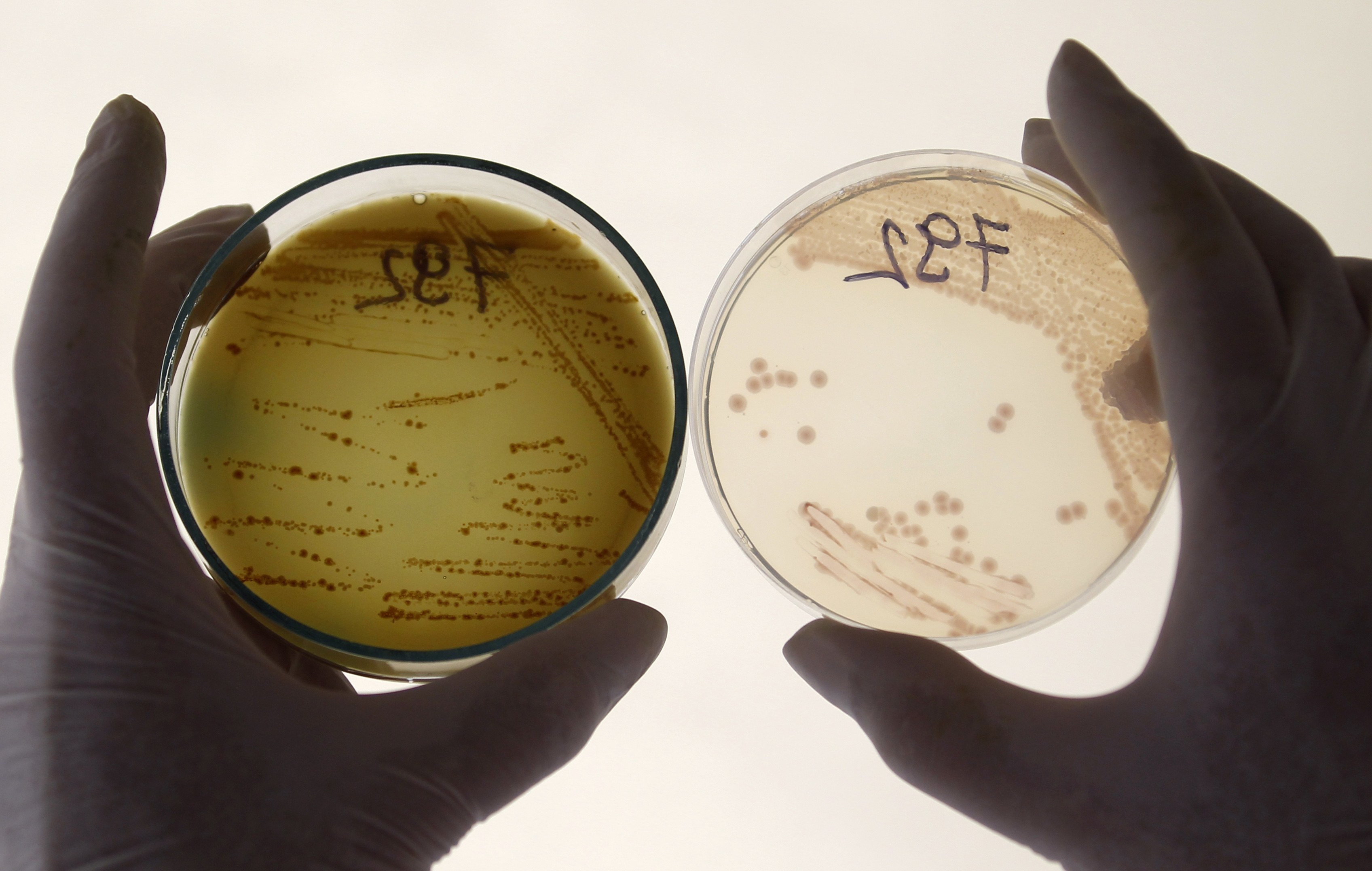 Γάλλια: σε τεχνητό κώμα το δίχρονο αγοράκι που μολύνθηκε από το E.coli