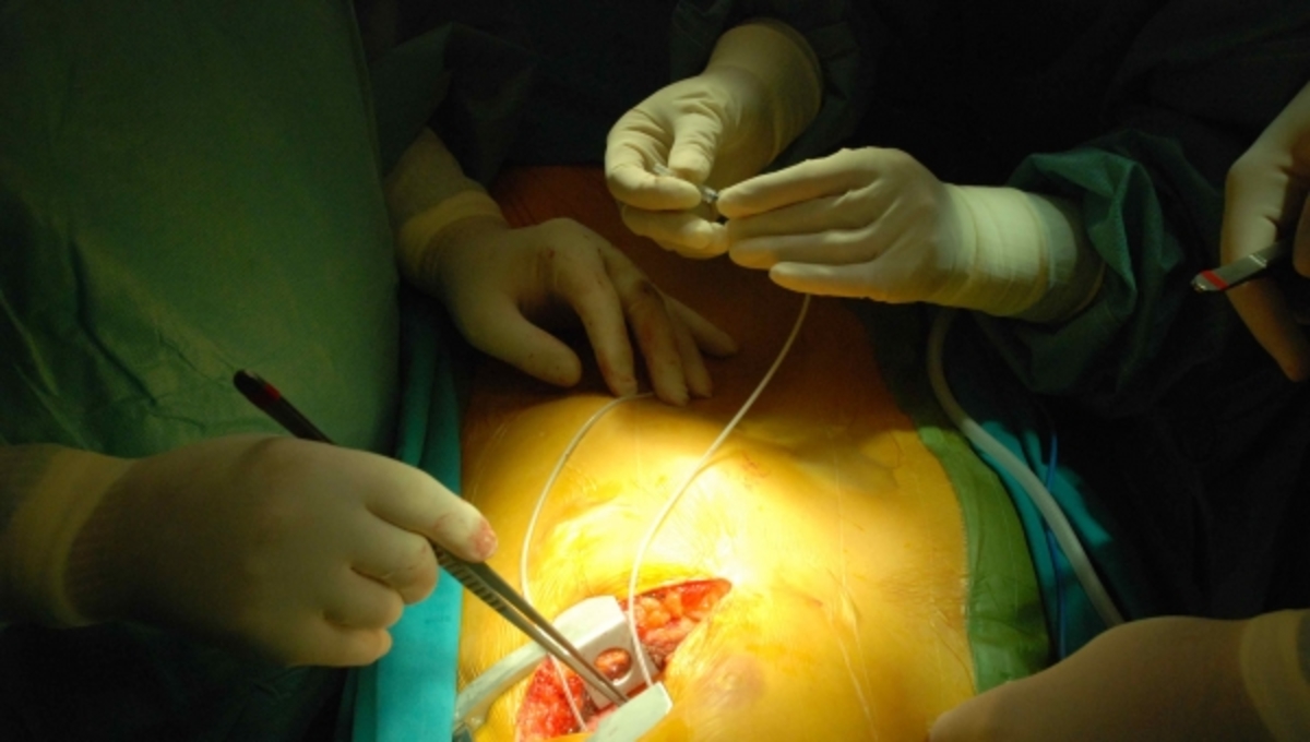 Στεφανιογραφία… εξπρές!