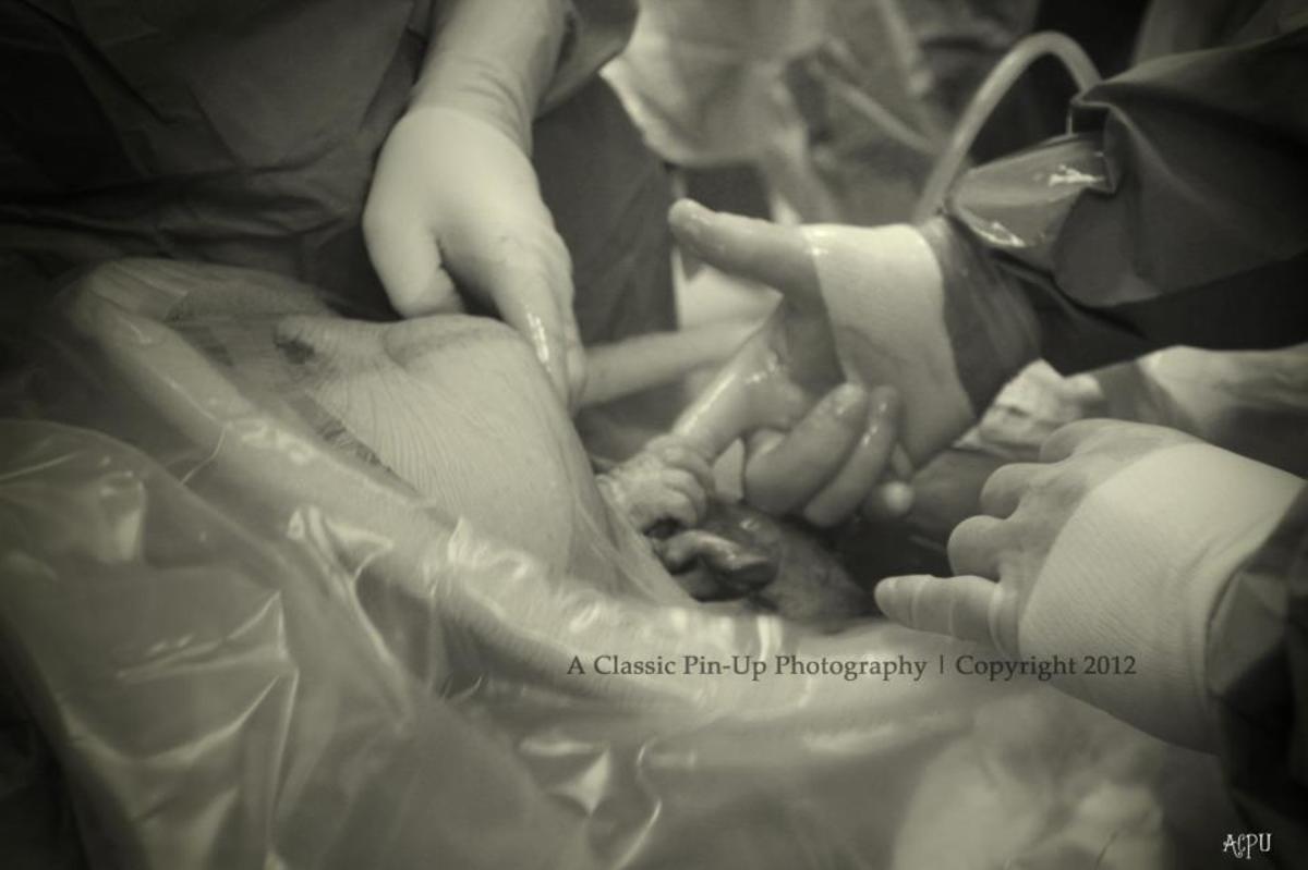 Μαγική στιγμή! Η “χειραψία” βρέφους με τον γιατρό την ώρα της γέννας! ΦΩΤΟ