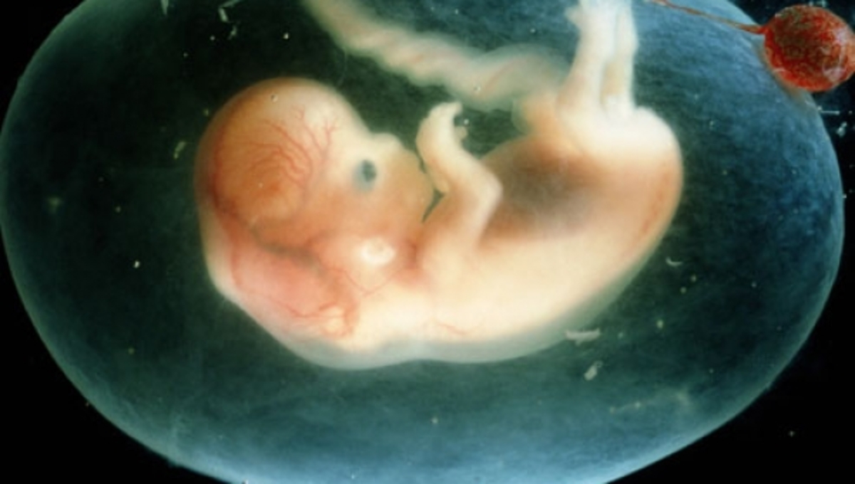 Τα πρώτα παιδιά με …3 γονείς θα είναι από την Αγγλία