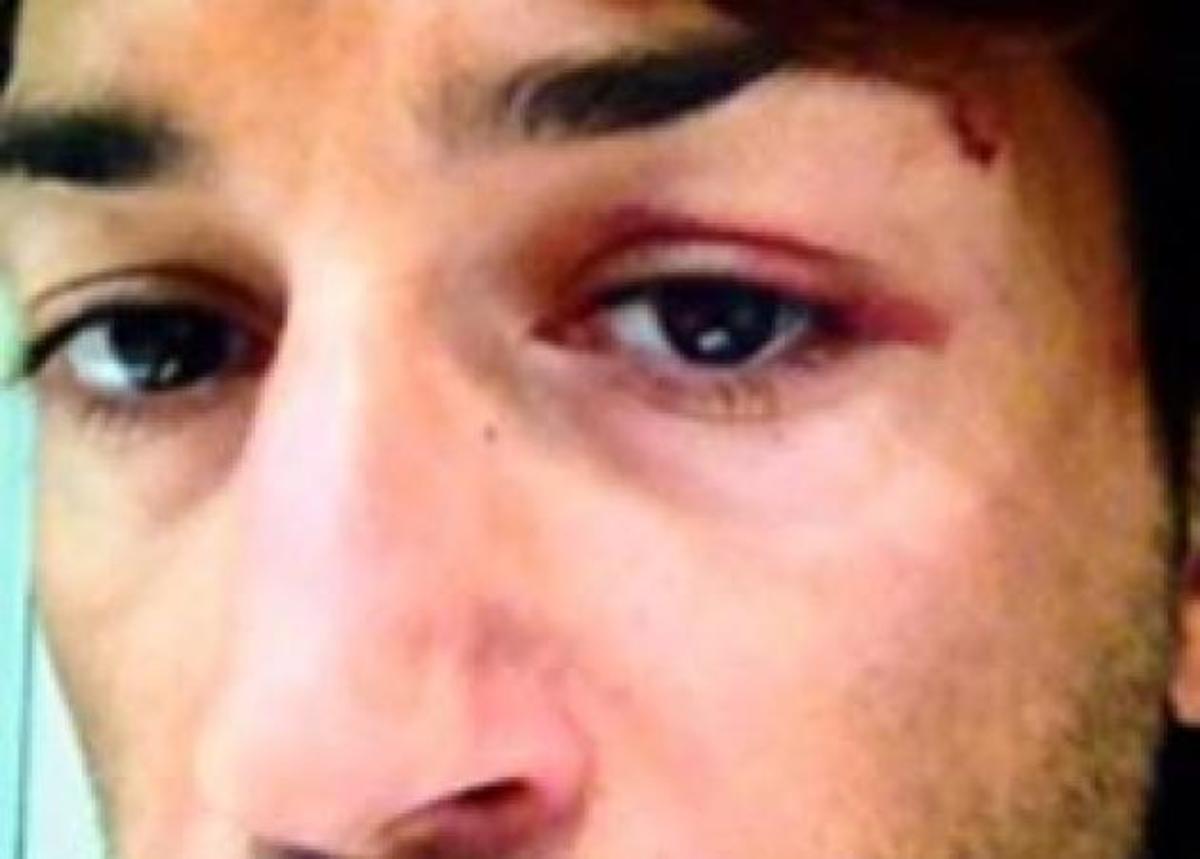 Θύμα ξυλοδαρμού ο make up artist, Κωνσταντίνος Εμμανουήλ: Το παράπονό του και  φωτογραφία στο facebook