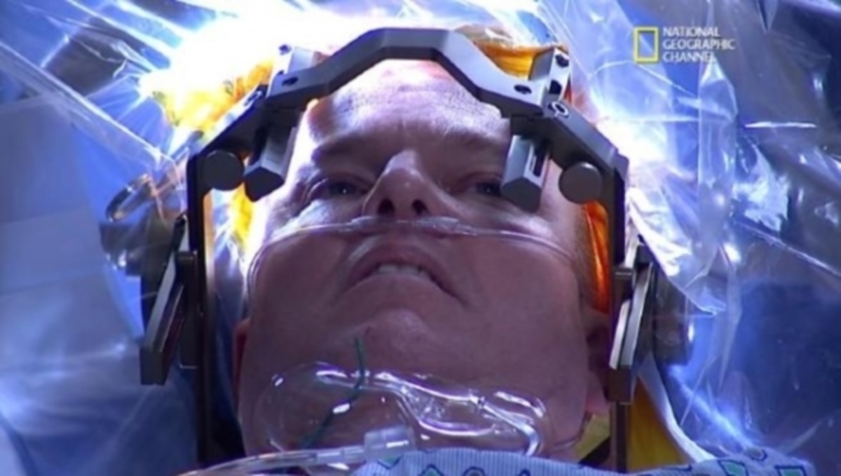 Εκπληκτικό: Δείτε την πρώτη LIVE επέβαση εγκεφάλου που μεταδόθηκε στην TV σε 171 χώρες (ΒΙΝΤΕΟ)