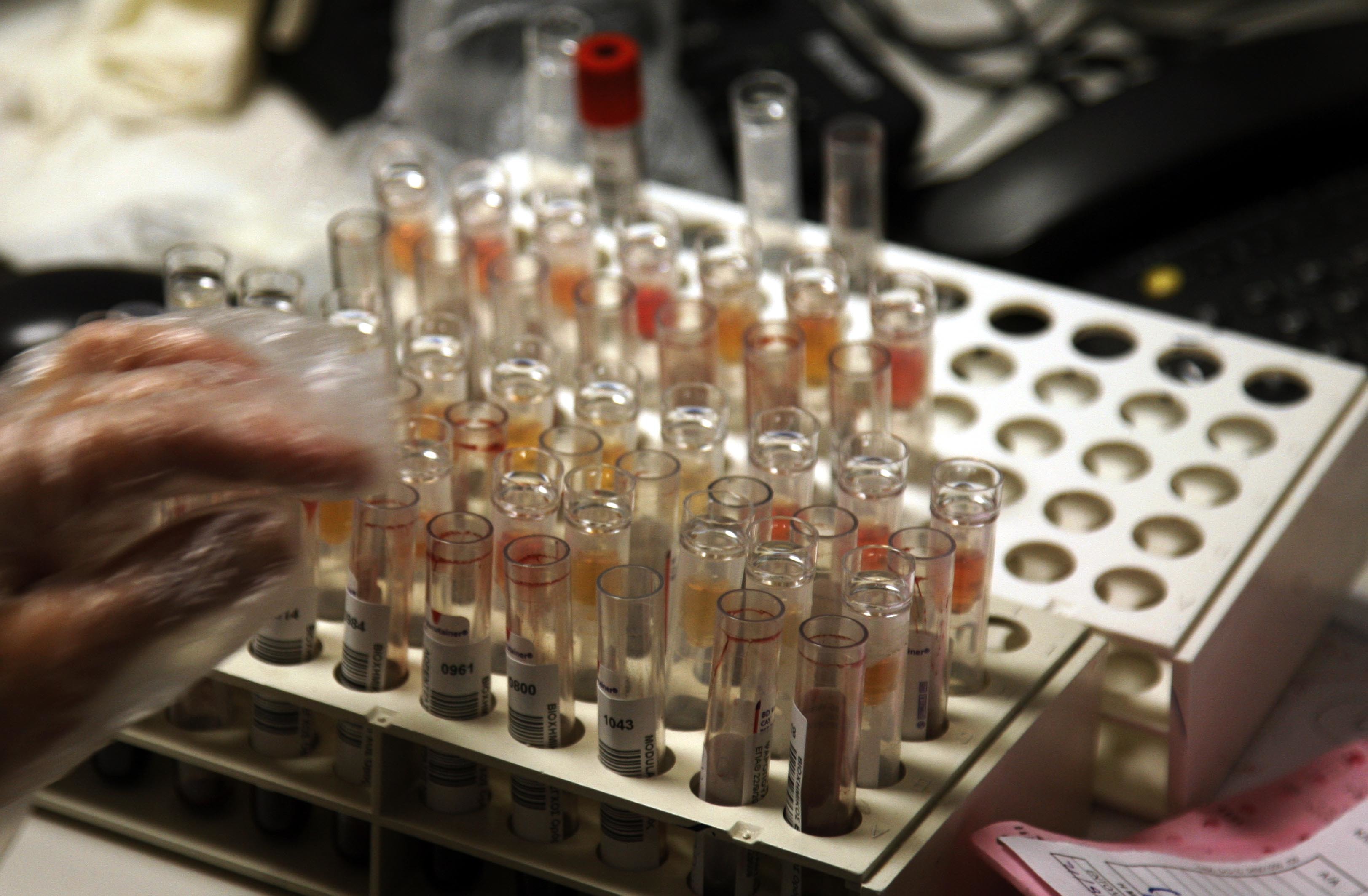 Μόνο ευχάριστα νέα στη μάχη κατά του AIDS