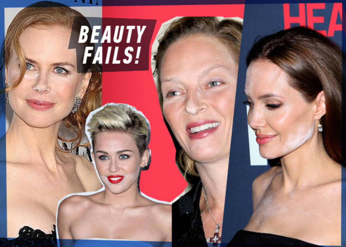 Beauty fails! Τι συνέβη στην Angelina Jolie και εμφανίστηκε έτσι;