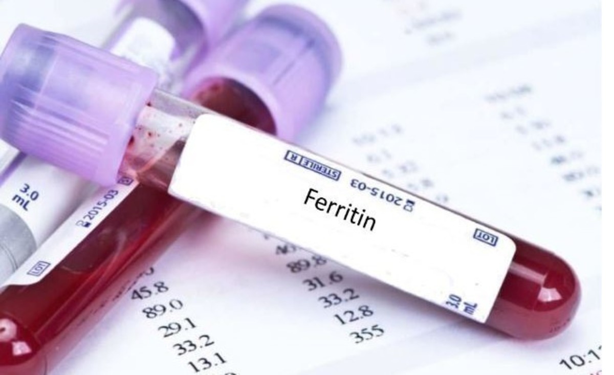 Φερριτίνη: Τι δείχνουν οι υψηλές και τι οι χαμηλές τιμές στο αίμα