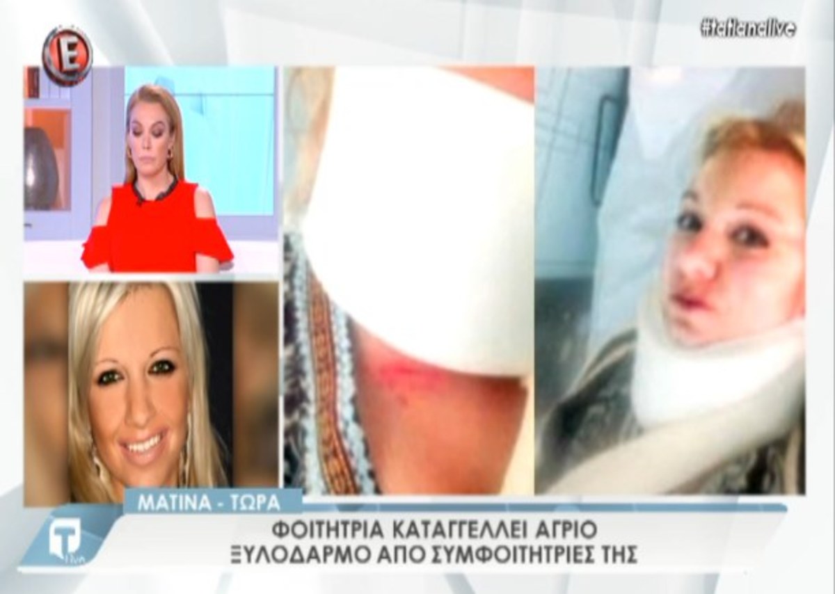 Φοιήτρια καταγγέλλει ξυλοδαρμό