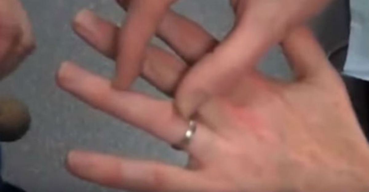Ο εύκολος τρόπος για να βγάλετε ένα δαχτυλίδι που έχει σφηνώσει στο δάχτυλο σας!