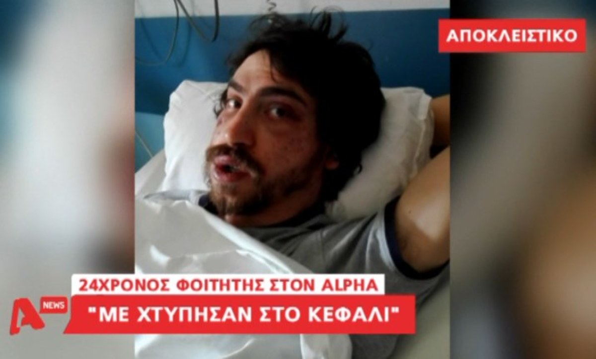 Ο φοιτητής που ξυλοκοπήθηκε