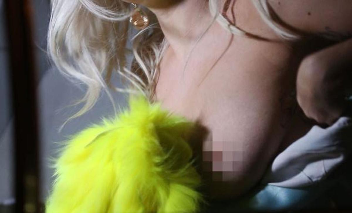 Το καυτό “ατύχημα” διάσημης τραγουδίστριας στα γυρίσματα σειράς που θα πρωταγωνιστήσει!