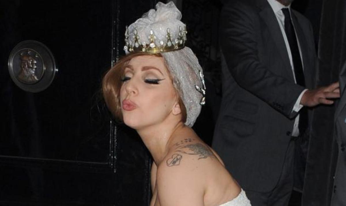 Συγκλονιστική εξομολόγηση από την Lady Gaga: “Μου πήρε δυο χρόνια μετά την επέμβαση…”