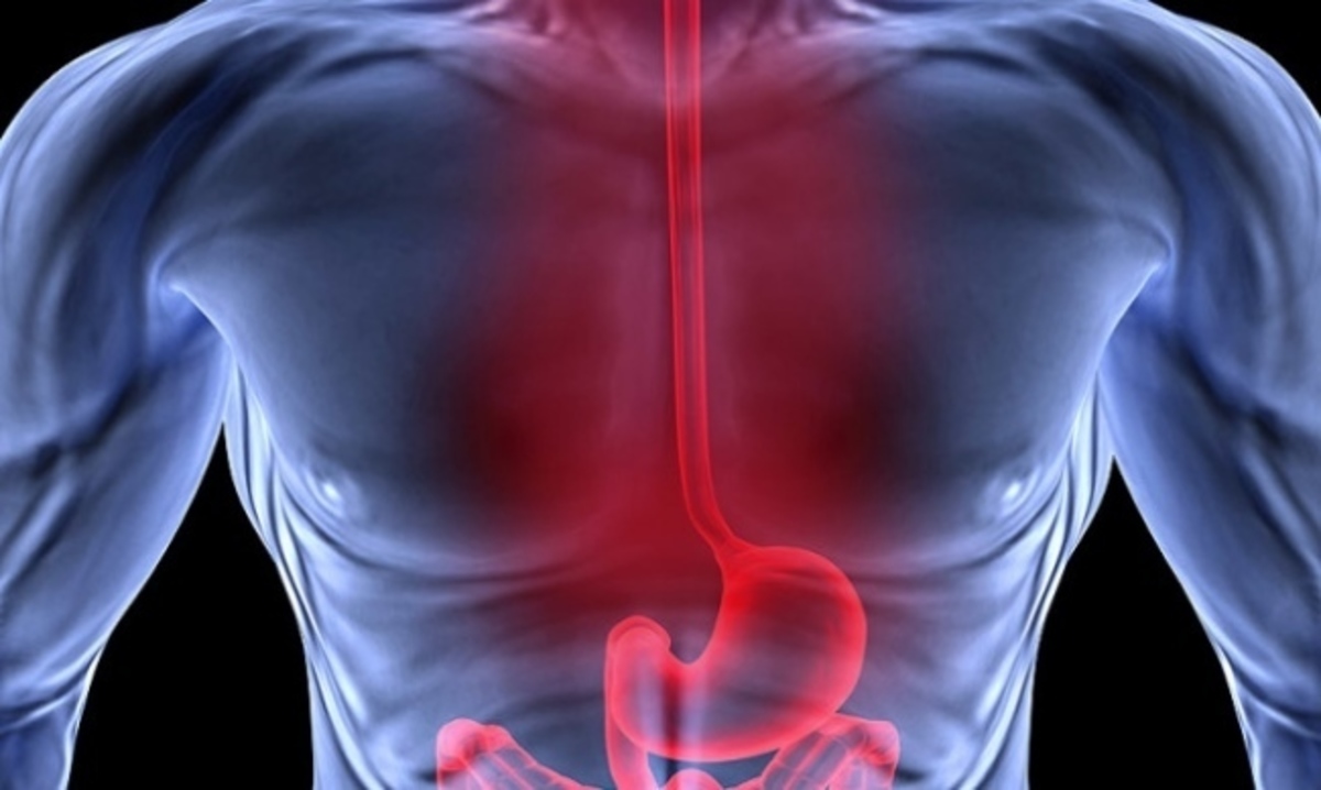 Γαστροοισοφαγική παλινδρόμηση: Προσοχή σε 4 απρόσμενα συμπτώματα