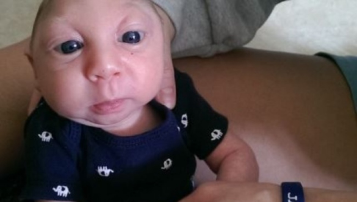 Γεννήθηκε με μισό κρανίο! Πρώτα γενέθλια για ένα αξιολάτρευτο ‘θαύμα’ (ΦΩΤΟ-ΒΙΝΤΕΟ)