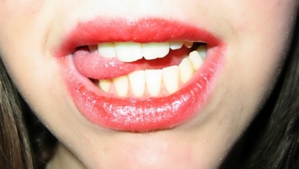 Τι πρέπει να κάνετε αν κατά λάθος δαγκώσετε τη γλώσσα σας