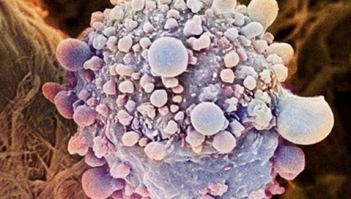 Γονίδιο σκοτώνει “εκ των έσω” τα καρκινικά κύτταρα
