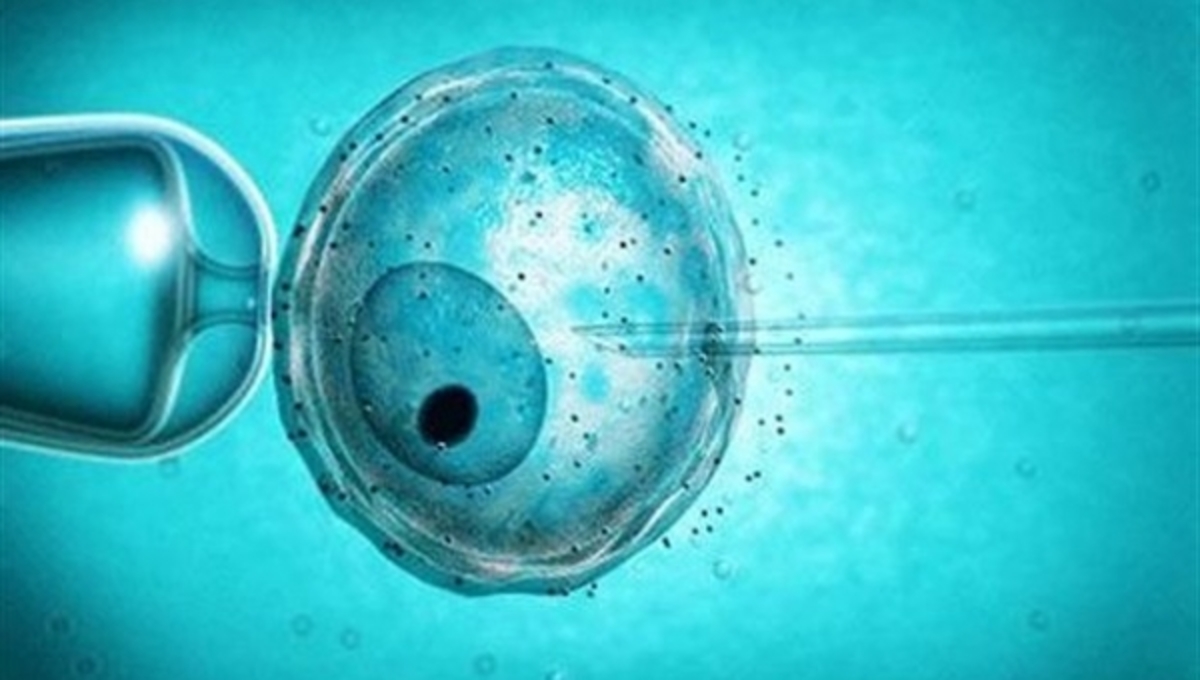 Τι απαιτείται για κάλυψη εξωσωματικής από τον ΕΟΠΥΥ! Πως θα αποζημιωθείτε