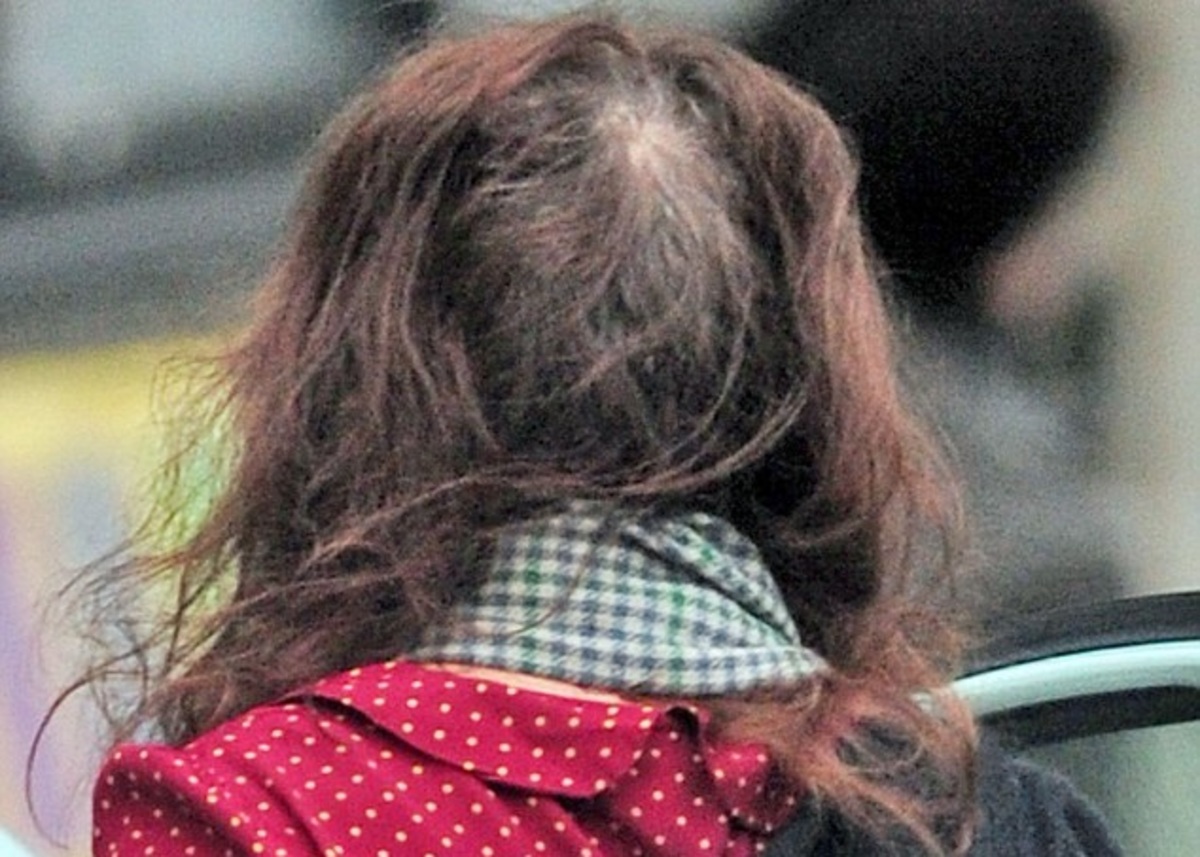 Πασίγνωστη ηθοποιός περπατούσε αγνώριστη στο δρόμο με σοβαρό πρόβλημα τριχόπτωσης!