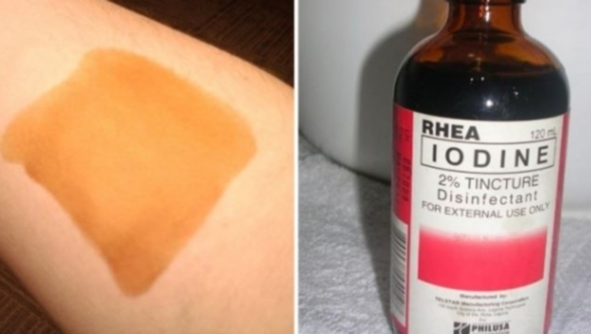 Το τεστ ιωδίου που δείχνει αν έχει πρόβλημα ο θυρεοειδής σας – Πώς να το κάνετε σε 24 ώρες