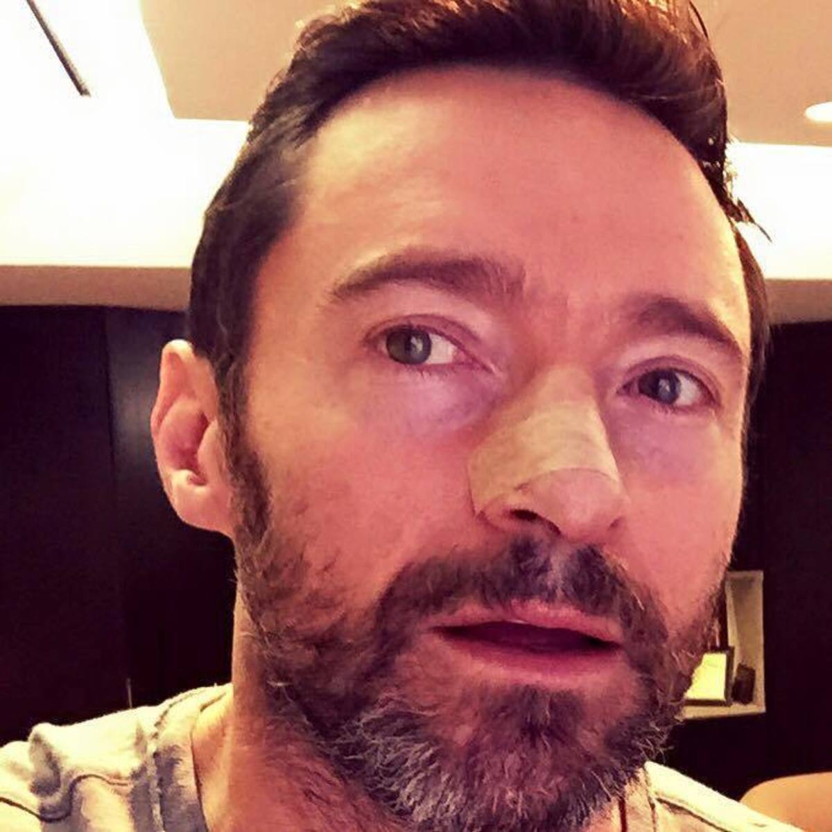 Ο καρκίνος “χτύπησε” ξανά τον Hugh Jackman – ΦΩΤΟ