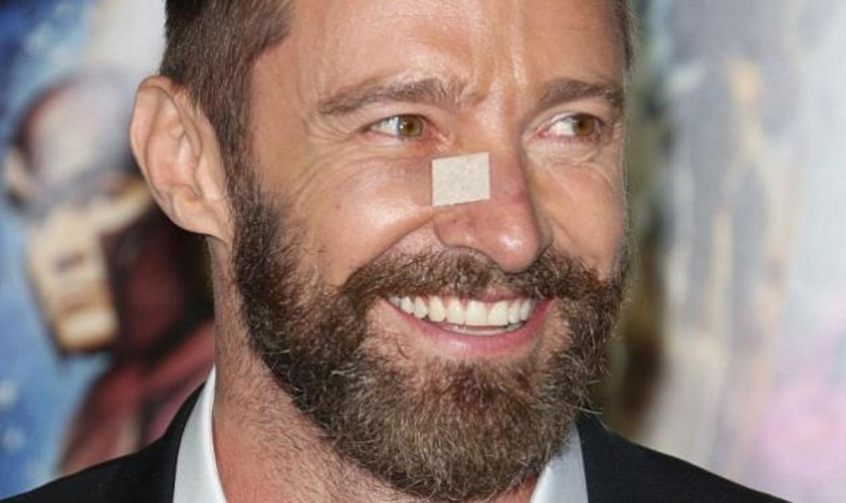 Δύσκολες ώρες για τον Hugh Jackman: Επέστρεψε ο καρκίνος