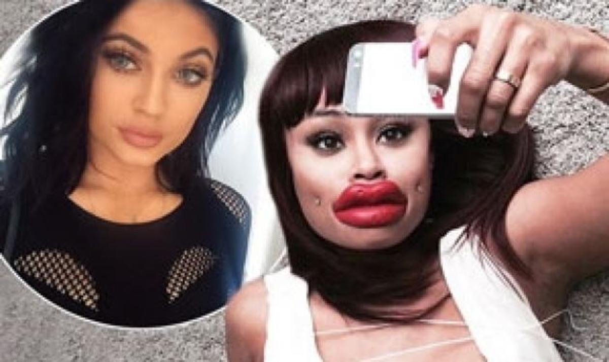 Kylie Jenner: Xαμός στο διαδίκτυο με τα χείλη της αδερφής της Kim Kardashian! Φωτό και βίντεο