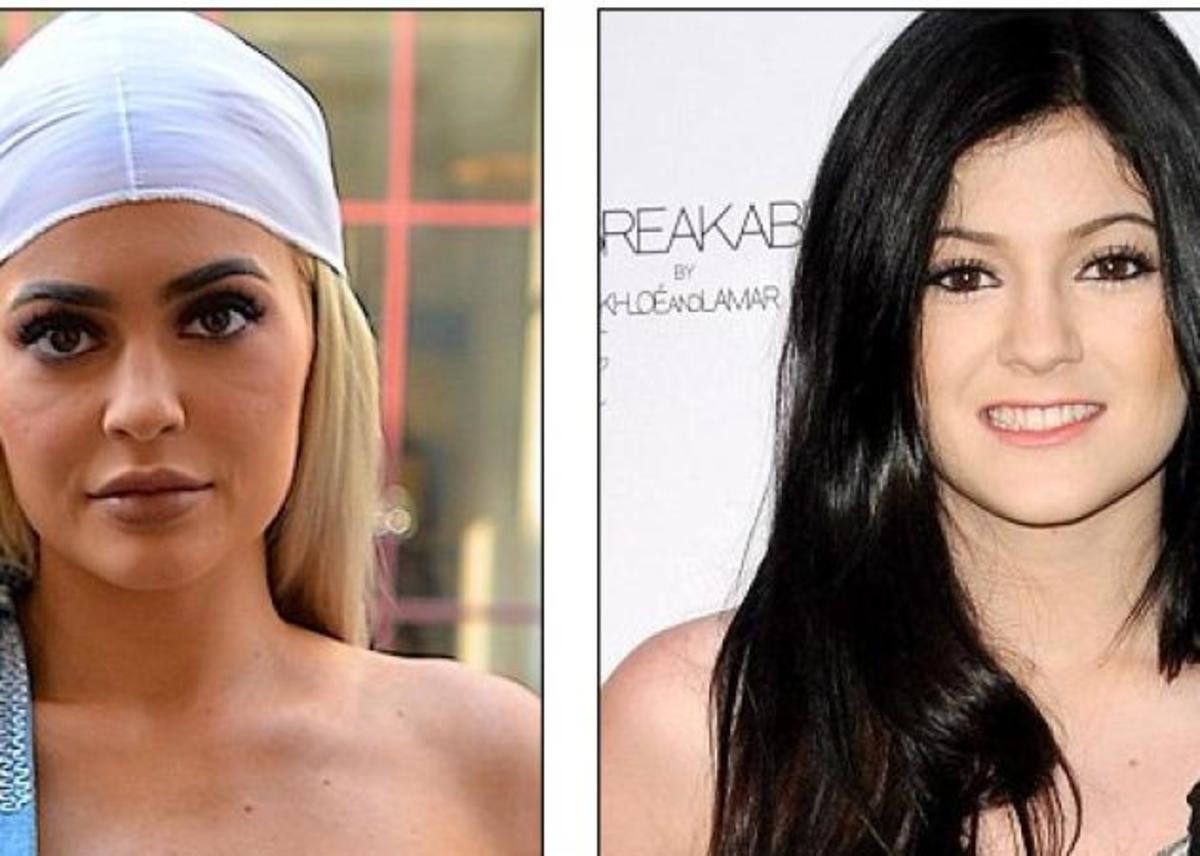 Kylie Jenner: Την κατηγορούν ότι άλλαξε τελείως από τις πλαστικές![pics]