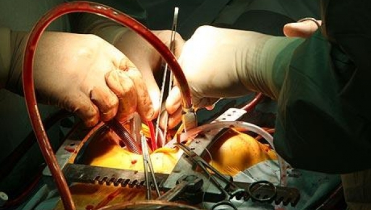 Καρδιοχειρουργική: Όλες οι εξελίξεις στις επεμβάσεις της καρδιάς