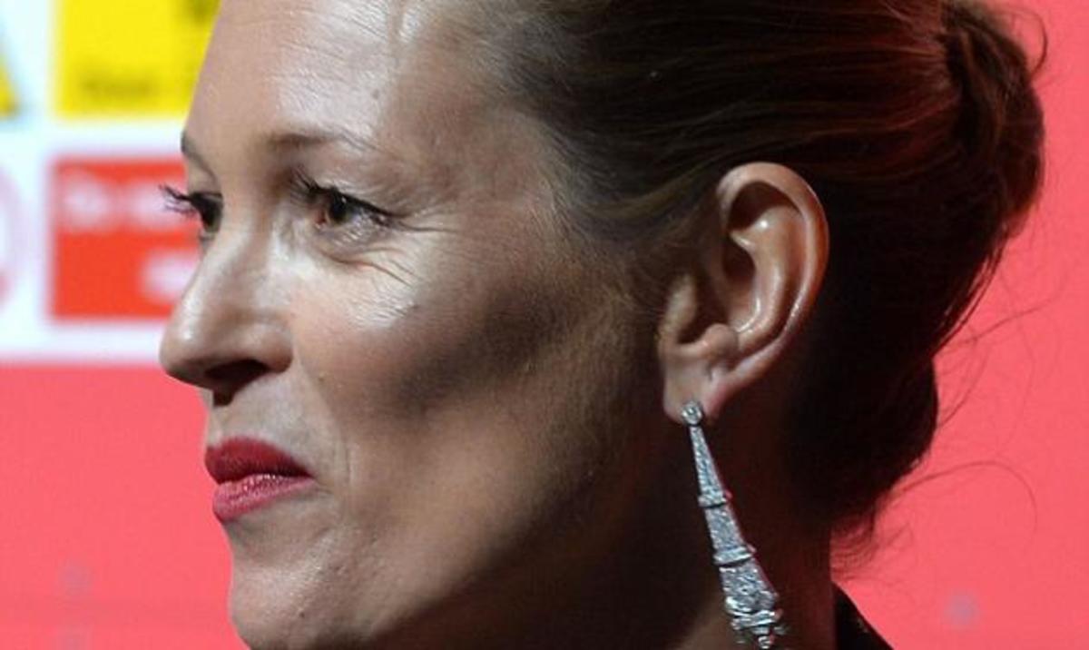 Οι έντονες ρυτίδες της Kate Moss σοκάρουν