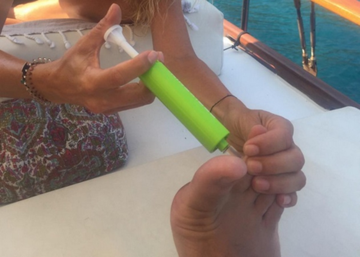 Σφίγγα τσίμπησε Έλληνα παρουσιαστή στις διακοπές του! Πώς το αντιμετώπισε