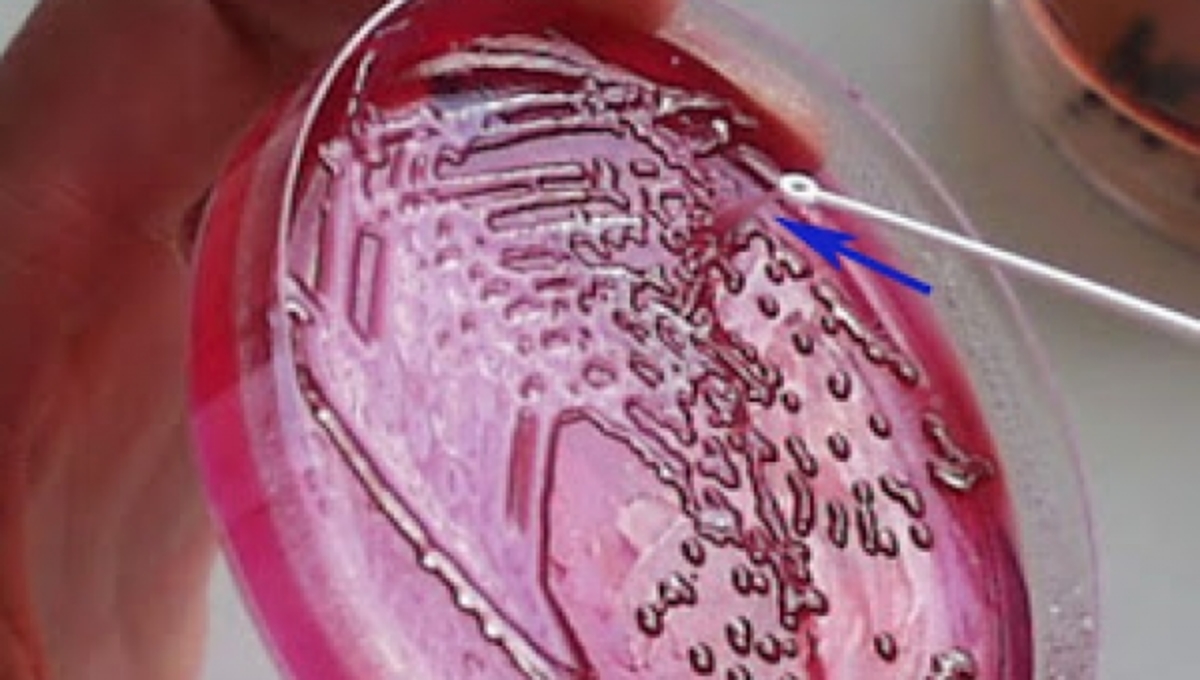 Κλεμπσιέλλα: το βακτήριο που σκότωσε τα νεογνά στη Θεσσαλονίκη – Διαβάστε τι είναι