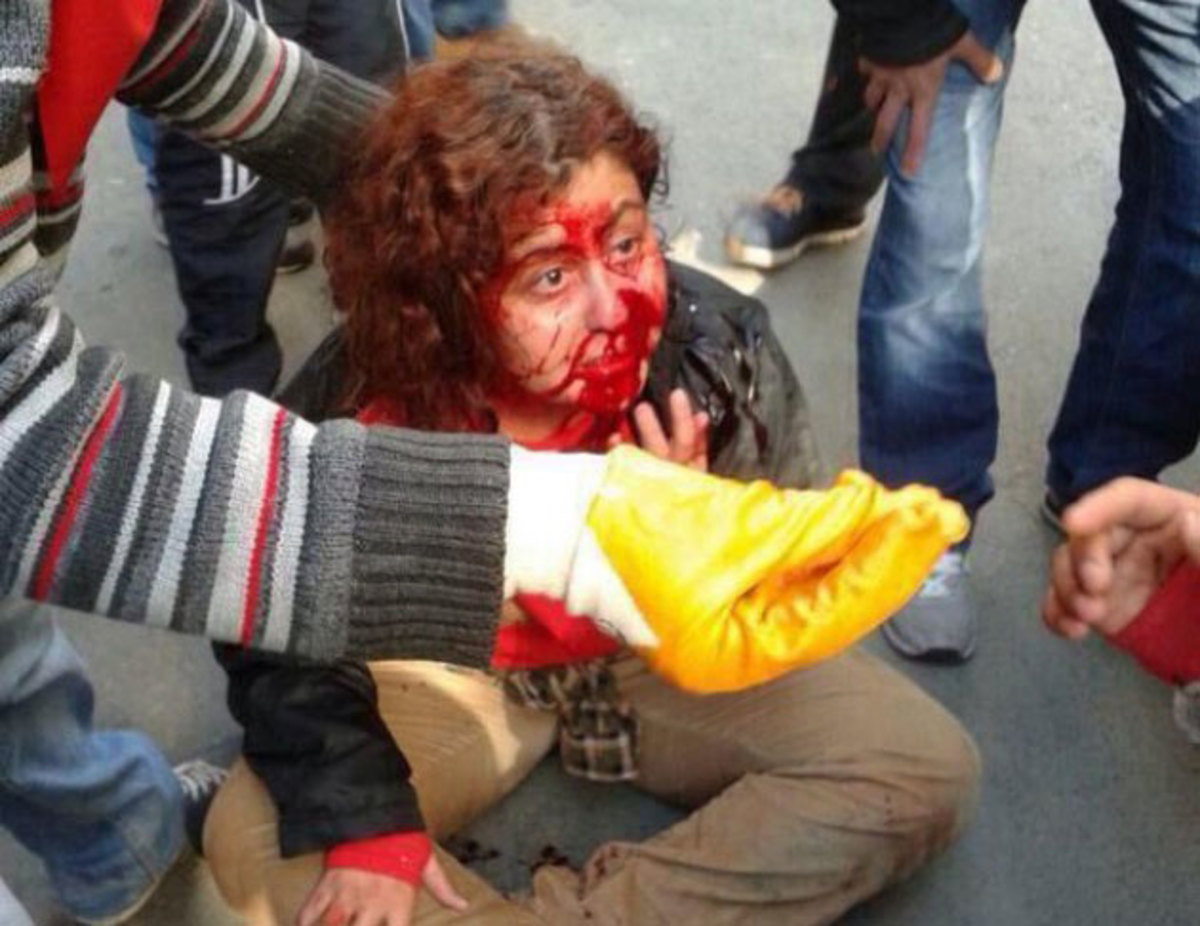 Βάφτηκε με αίμα η Πρωτομαγιά στην Κωνσταντινούπολη – Η Ταξίμ καιγόταν και οι αστυνομικοί έβγαζαν… selfie! Συγκλονιστικές εικόνες και video