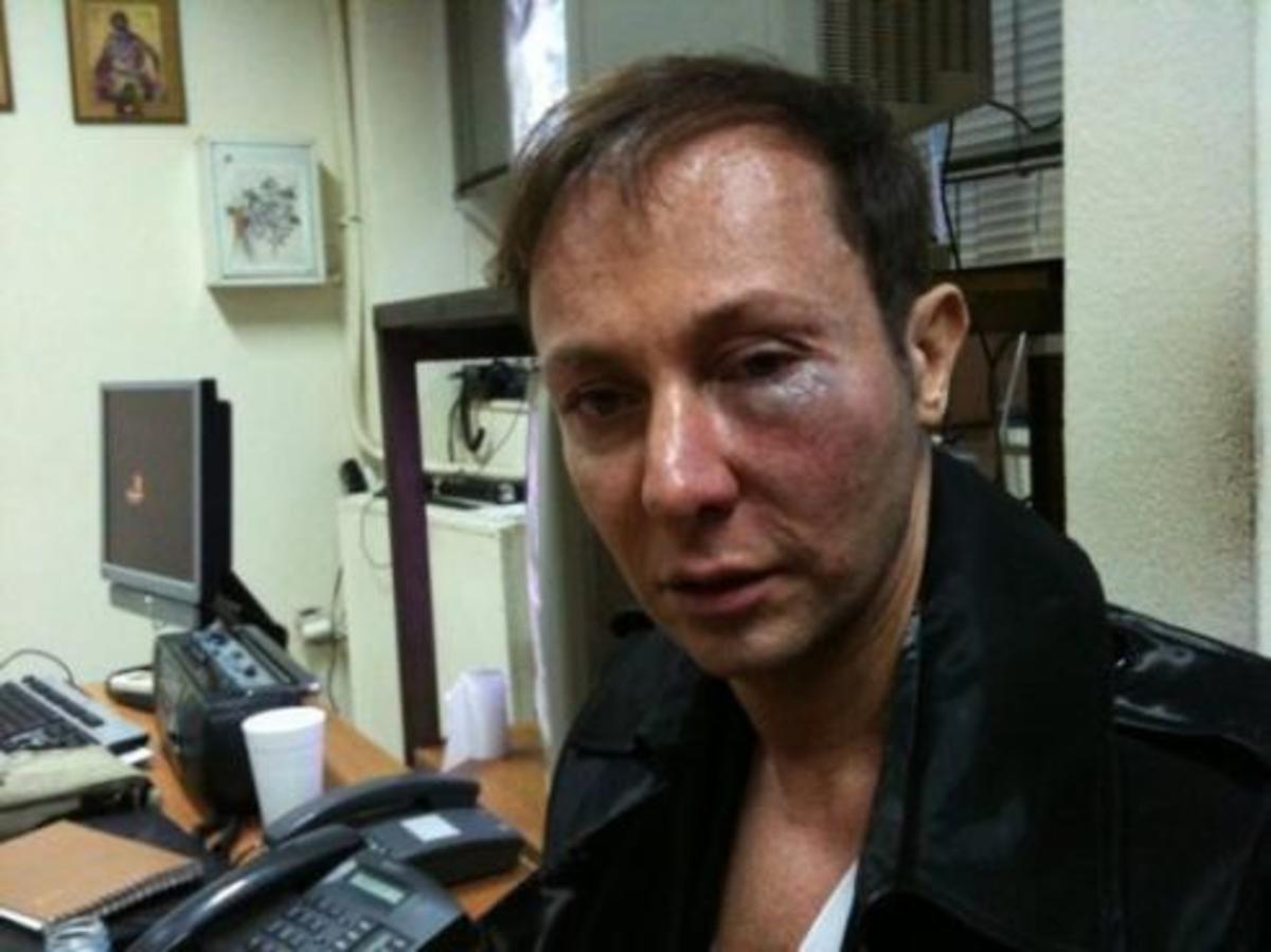 “Mετάνιωσα που χτύπησα τον Κωστέτσο”!