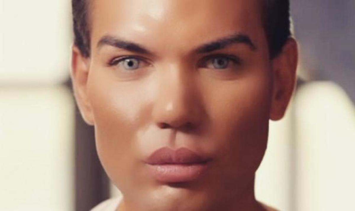 Δεν θα πιστεύεις πόσα χρήματα ξόδεψε σε πλαστικές για να μεταμορφωθεί στον κούκλο Κen!