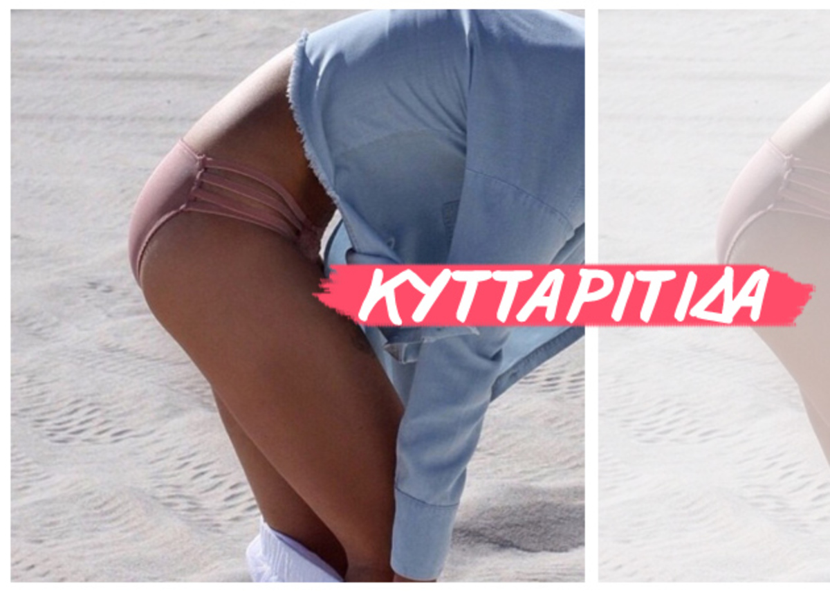 Κυτταρίτιδα: Πράγματα που δεν γνώριζες!