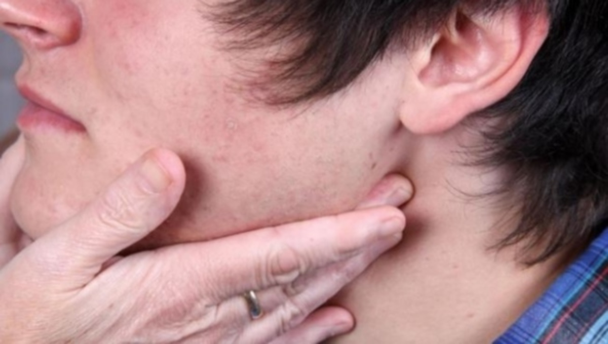 Προσοχή: Πότε το πρήξιμο στον λαιμό είναι σημάδι λεμφώματος – Όλα τα συμπτώματα