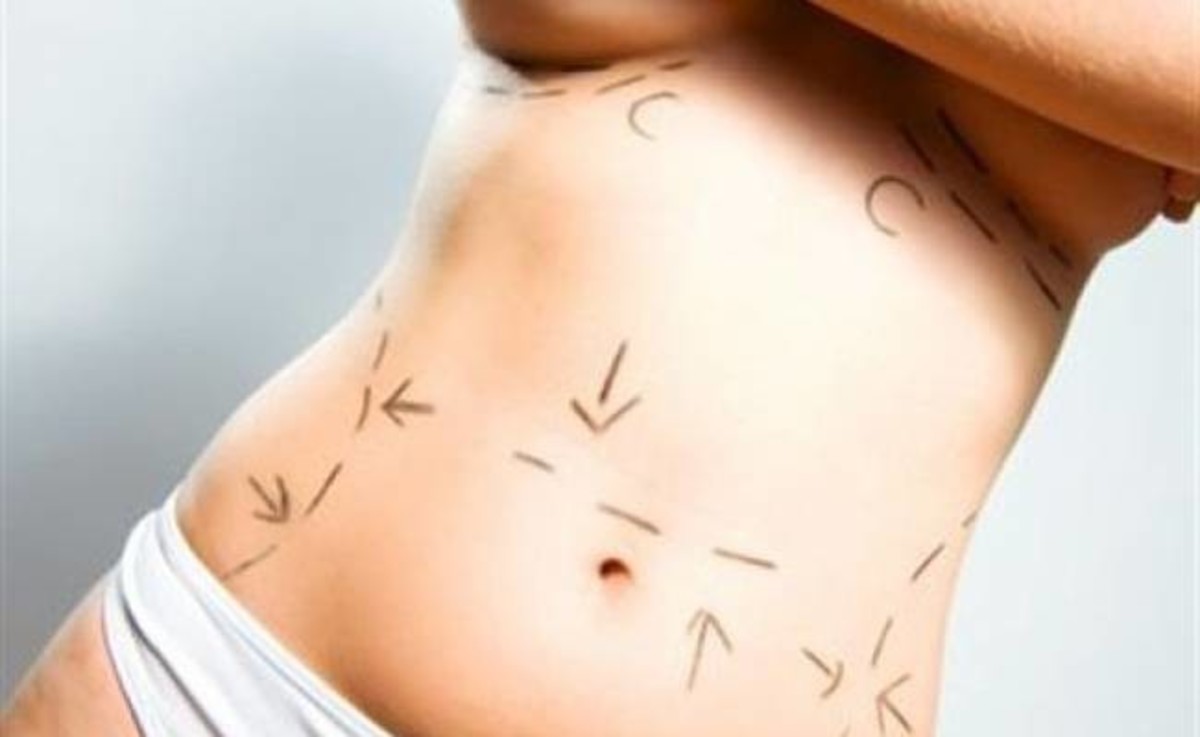 Βγήκε από χειρουργείο πιο αδύνατη και με μεγαλύτερο στήθος αλλά και …κλεπτομανής