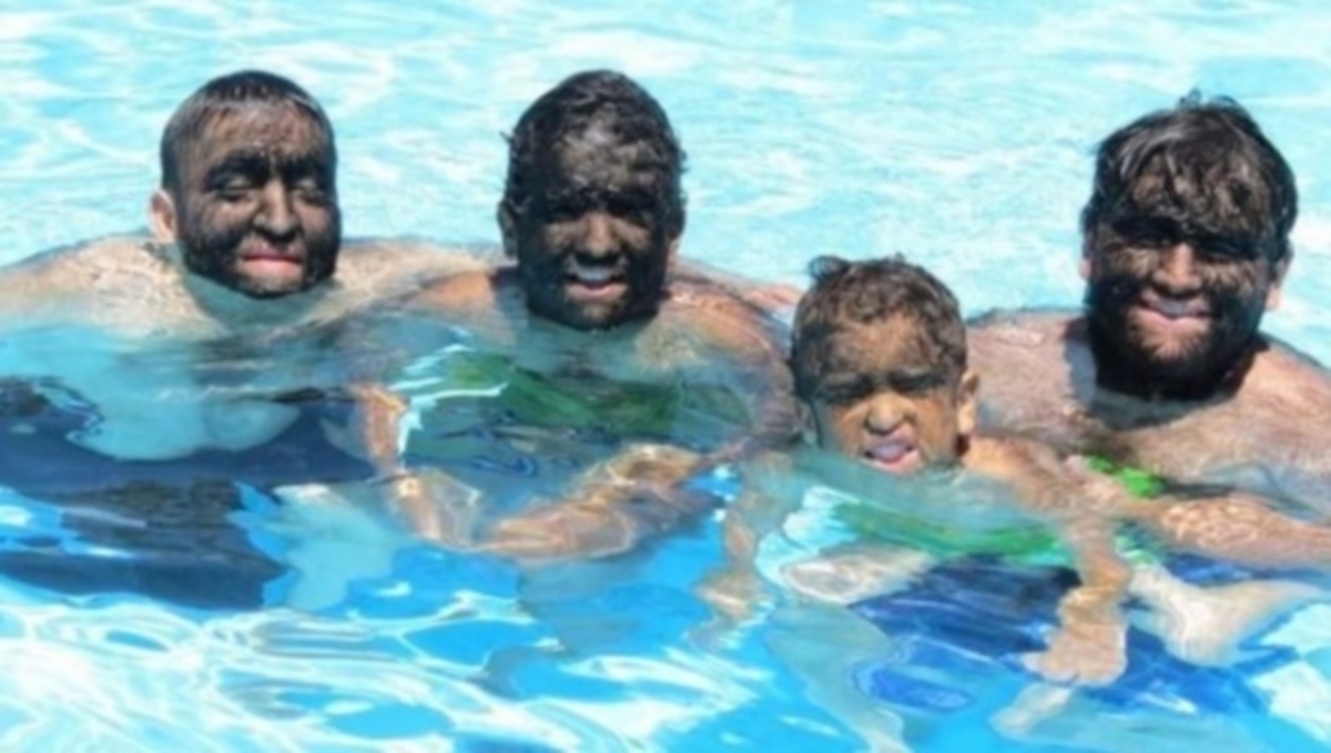 Αποκαλούν τα μέλη αυτής της οικογένειας “λύκους” – Δείτε τι τους συμβαίνει (φωτογραφίες)