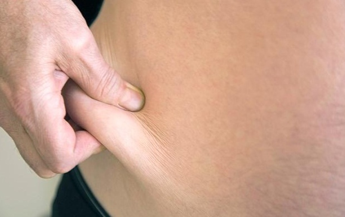 Οι άνδρες με κοιλίτσα κινδυνεύουν να πάθουν οστεοπόρωση