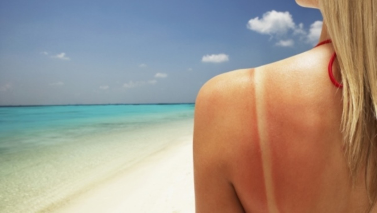 Τα 6 λάθη που σίγουρα κάνετε στο μαύρισμα και πώς να τα αποφύγετε